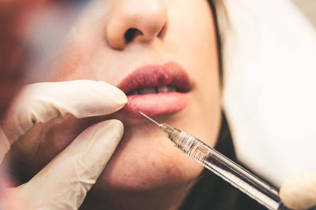 Lip Augmentation Options 2