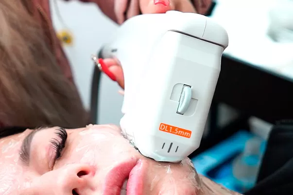 HIFU Neck & Décolletage treatment at Vive Medical Spa