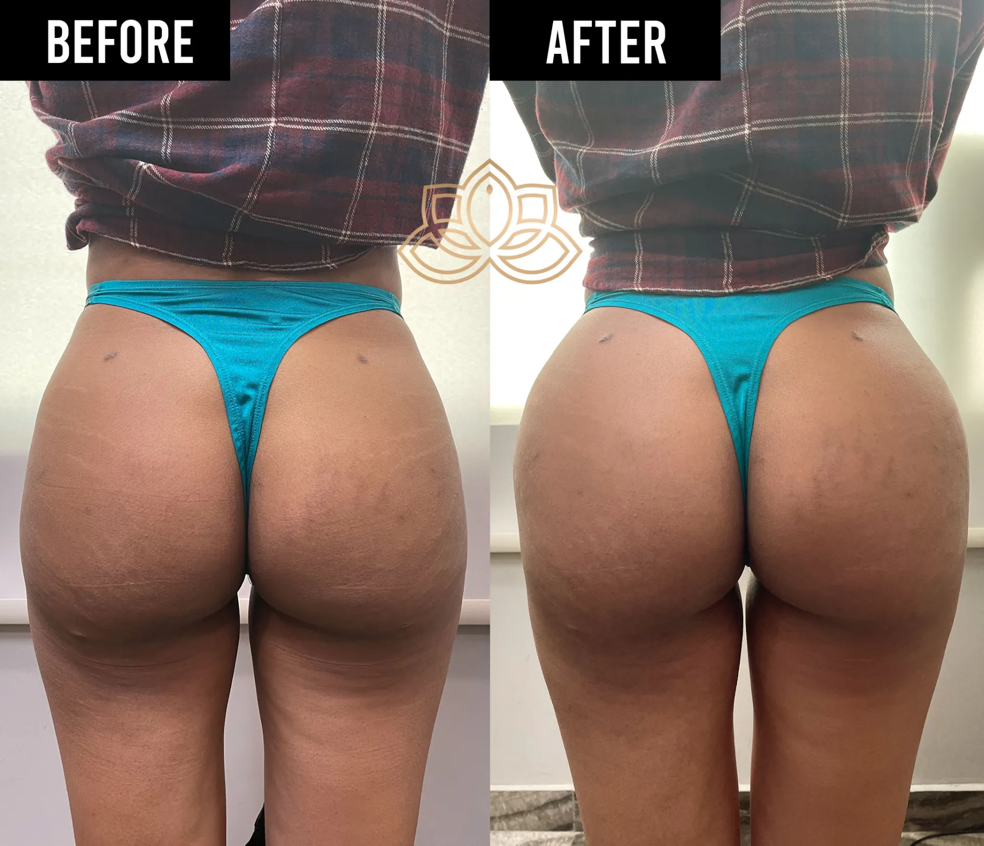 Butt Filler after