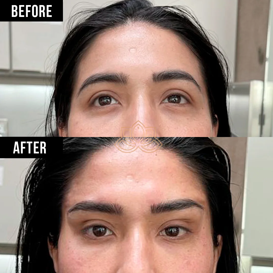 Foxy Eyes before