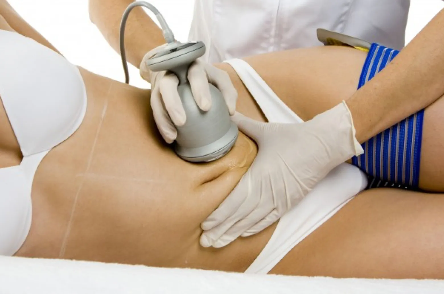 IPL Laser