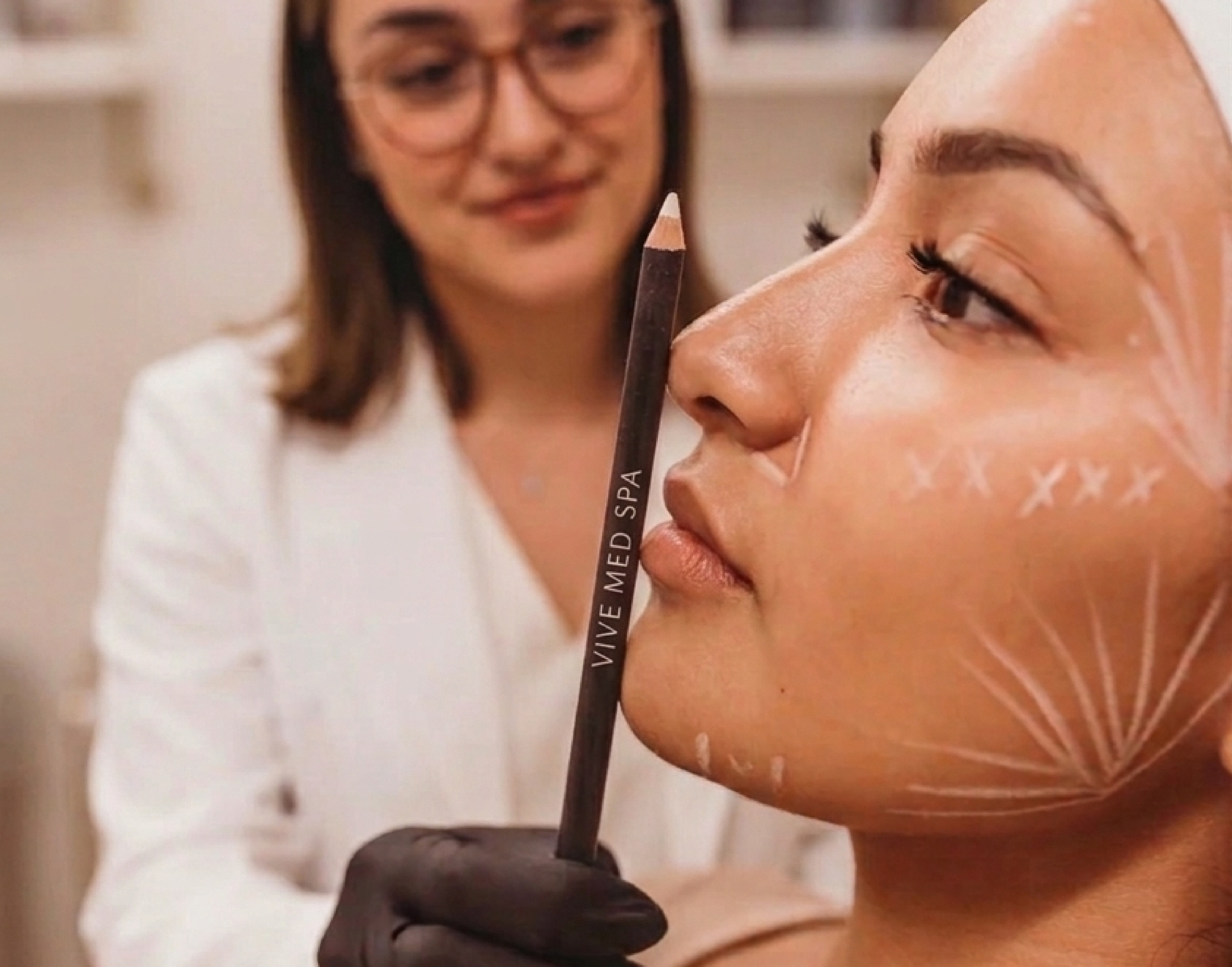 Chin Augmentation at Vive Medical Spa Tijuana