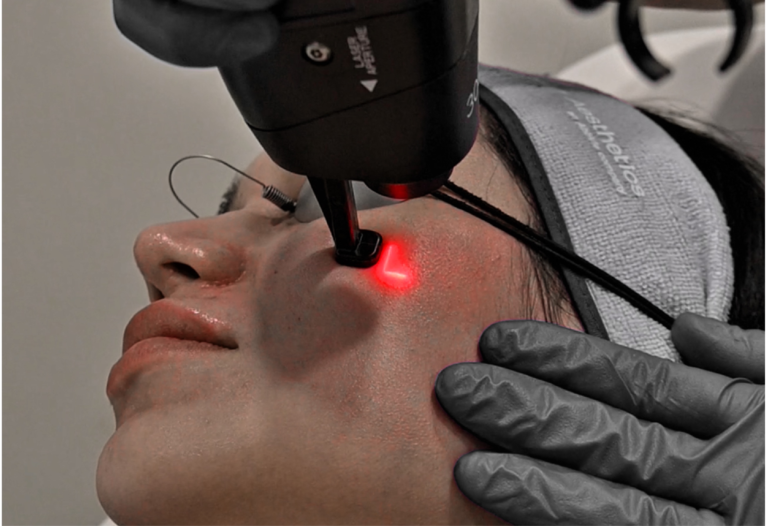 Vive Med Spa - CO2 Fractional Laser treatment room