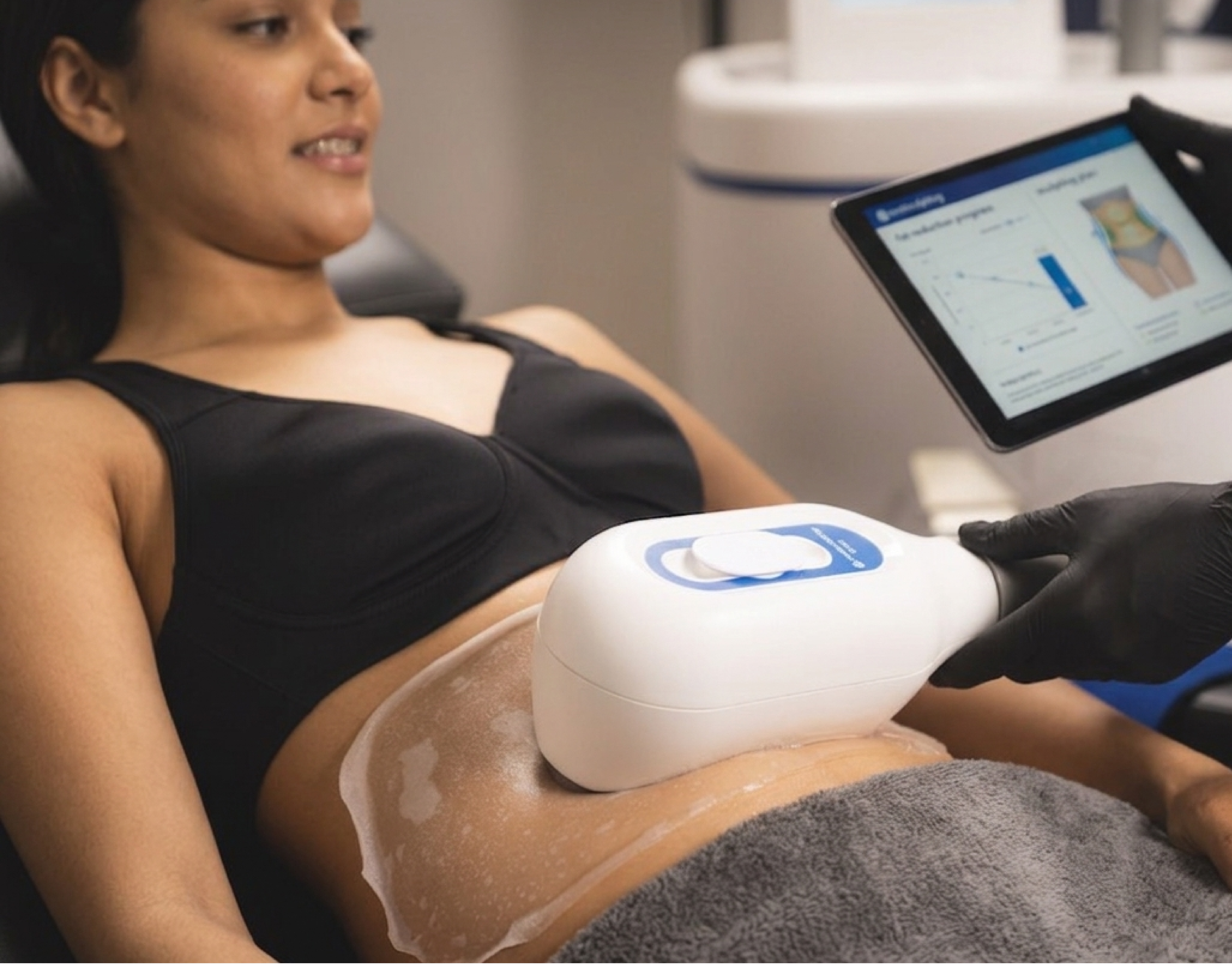 CoolSculpting at Vive Medical Spa Tijuana