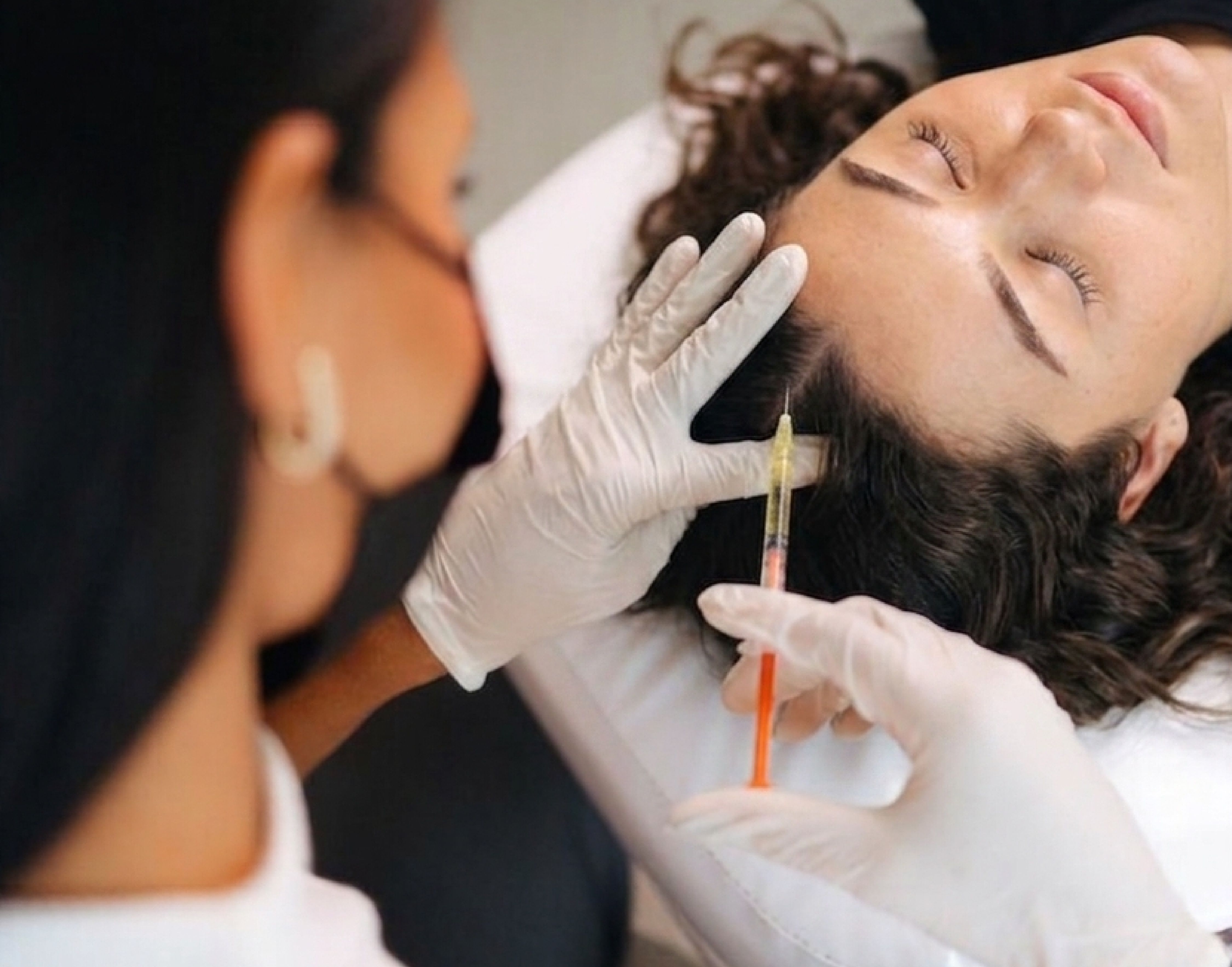 PRP therapy treatment at Vive Medical Spa
